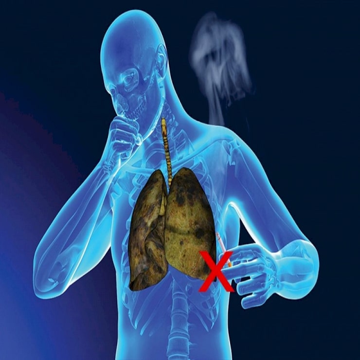  Tìm hiểu những thông tin xung quanh việc hút thuốc lá có hại như thế nào cho hệ hô hấp?